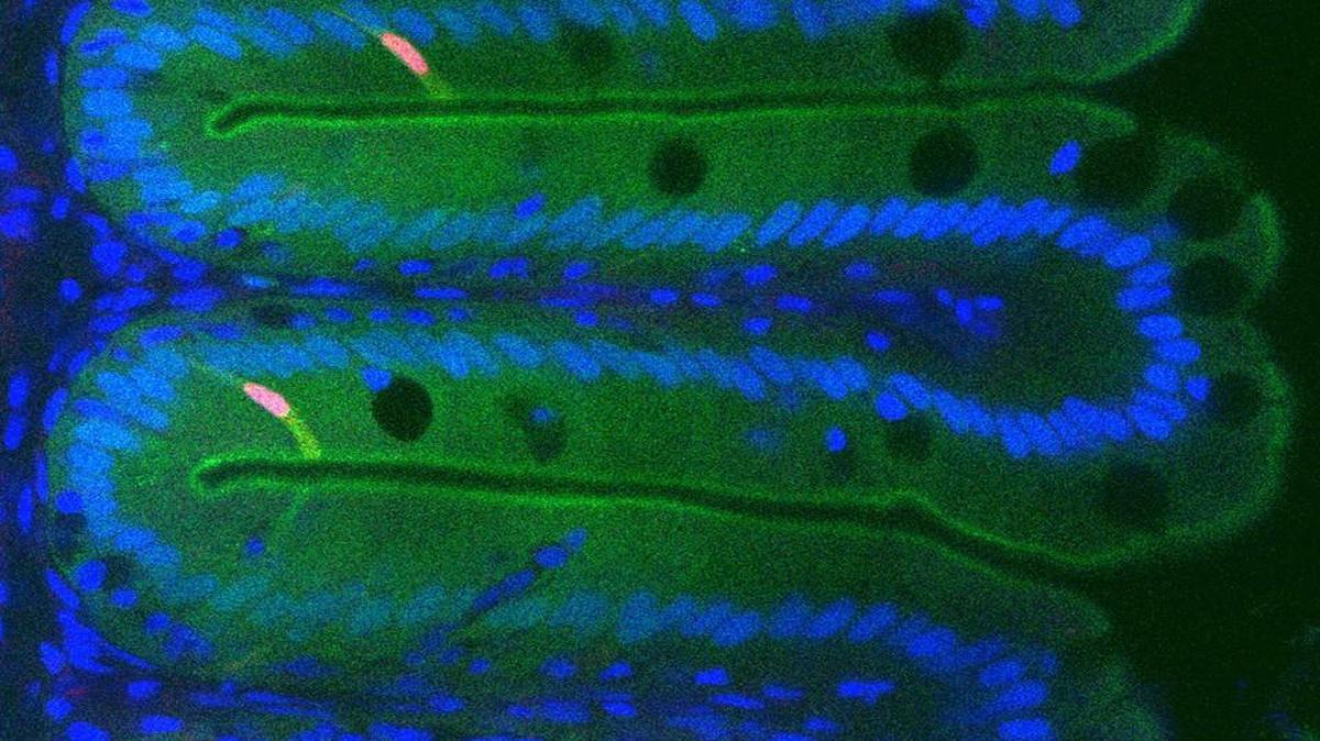 Fluorescence imaging of the zebrafish intestine reveals activity of ancient genetic regulatory elements. Nuclei of epithelial cells lining the intestine are shown in blue, and cells that have activated a regulatory element from the HES1 gene are shown in green.