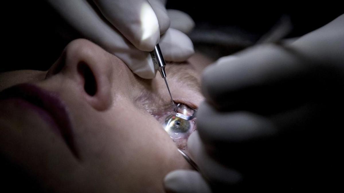 Dr. Mark Whitten performs a short eye surgery procedure on patient Christianne Krupinsky in Washington, Wednesday, Feb. 1, 2017, to insert a Raindrop inlay, a disc implanted in the cornea to reshape it for better close-up focus. A bill in the NC legislature would allow optometrists to perform laser procedures for glaucoma or cataracts and removal of lesions around the eyes.