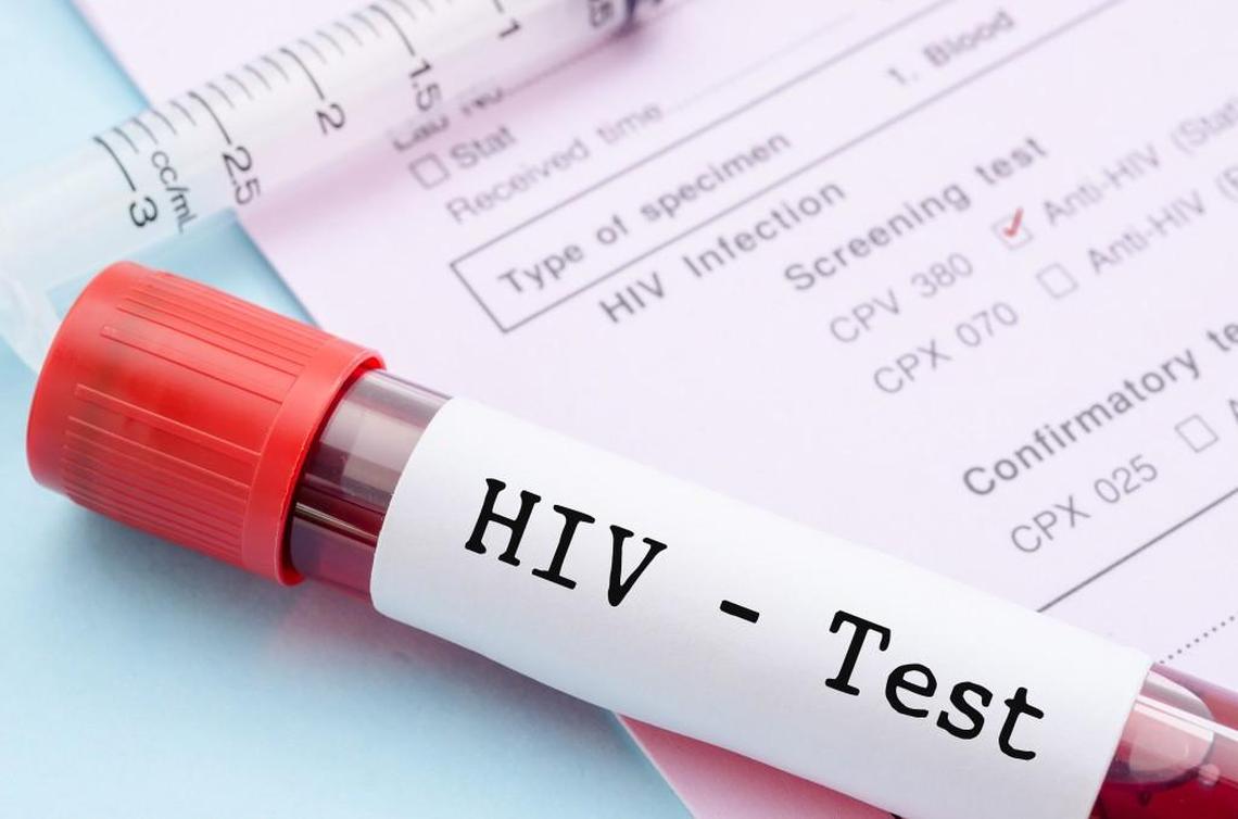 Each North Carolina city included on the list reported at least 206 cases of HIV in 2023.