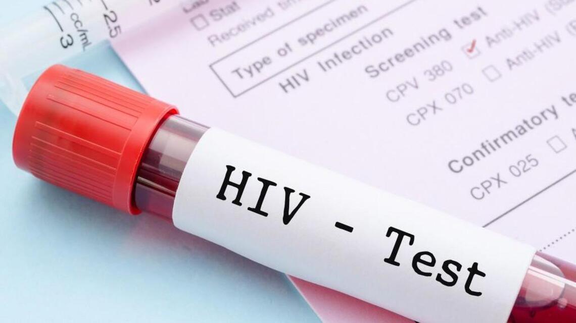 Op-ed: Let’s end the HIV/AIDS epidemic in the SC