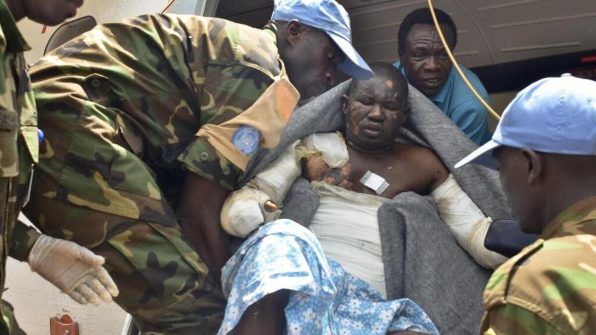 
Rwandan UN peacekeepers evacuate a burn victim to Juba by plane for medical treatment, one of many injured when a truck carrying petrol overturned and then exploded shortly after hundreds of villagers had gathered around to siphon fuel.
