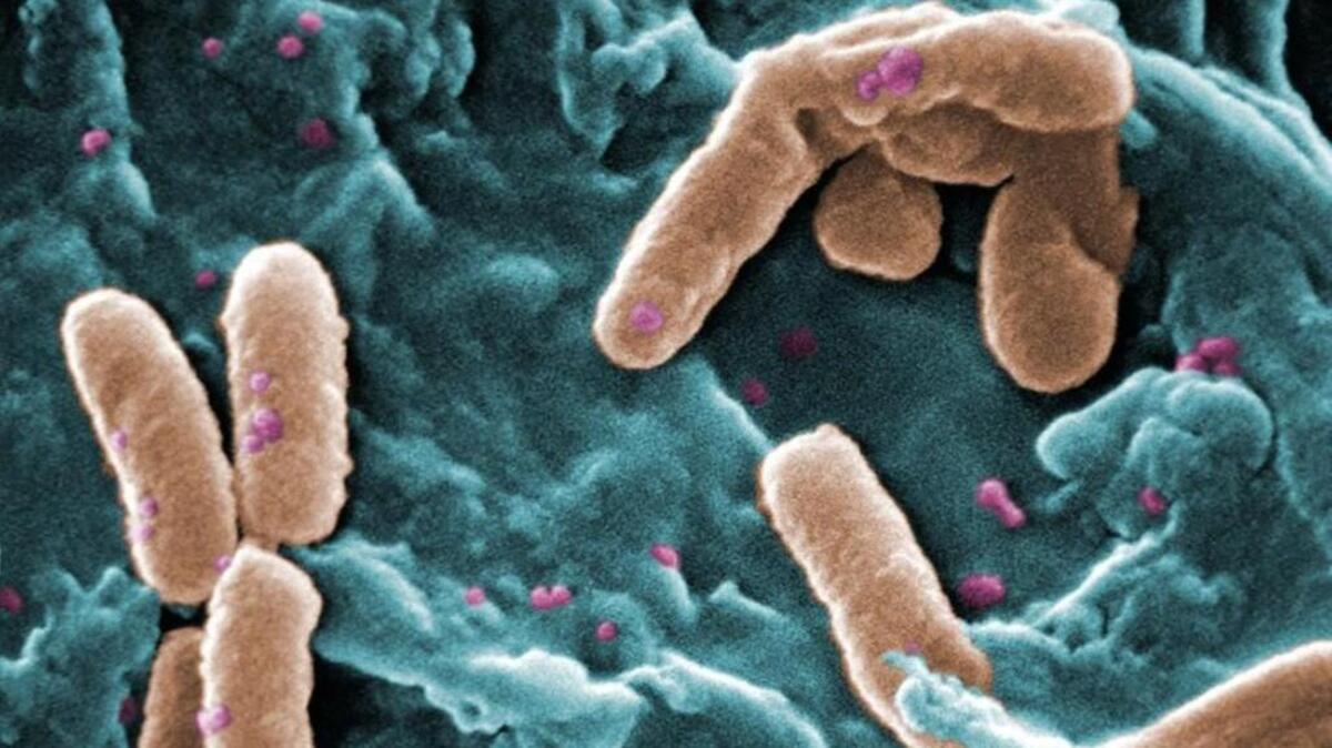 Pseudomonas aeruginosa bacteria.
