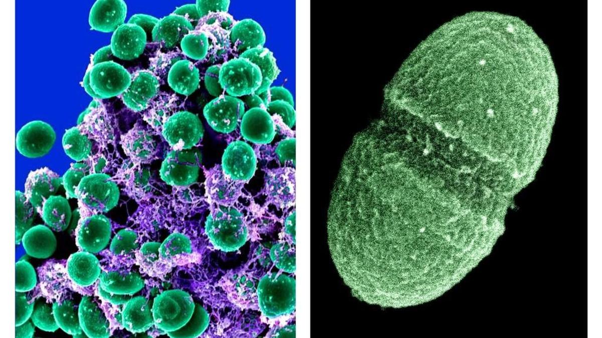 The bacterium Enterococcus faecalis, right, lives in the human gut and is just one microbe being studied as part of NIH’s Human Microbiome Project. But there has not been enough scientific research to determine whether microbiome skincare products work.