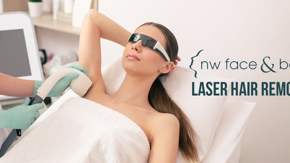 Who Does the Best Laser Hair Removal in Bellevue, WA? 