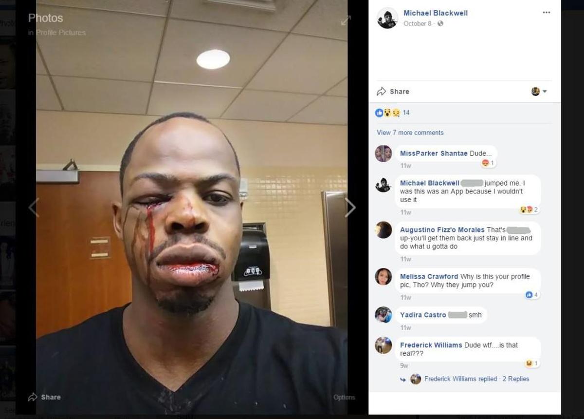 A screen grab from Michael Blackwell’s Facebook account shows him bloodied.