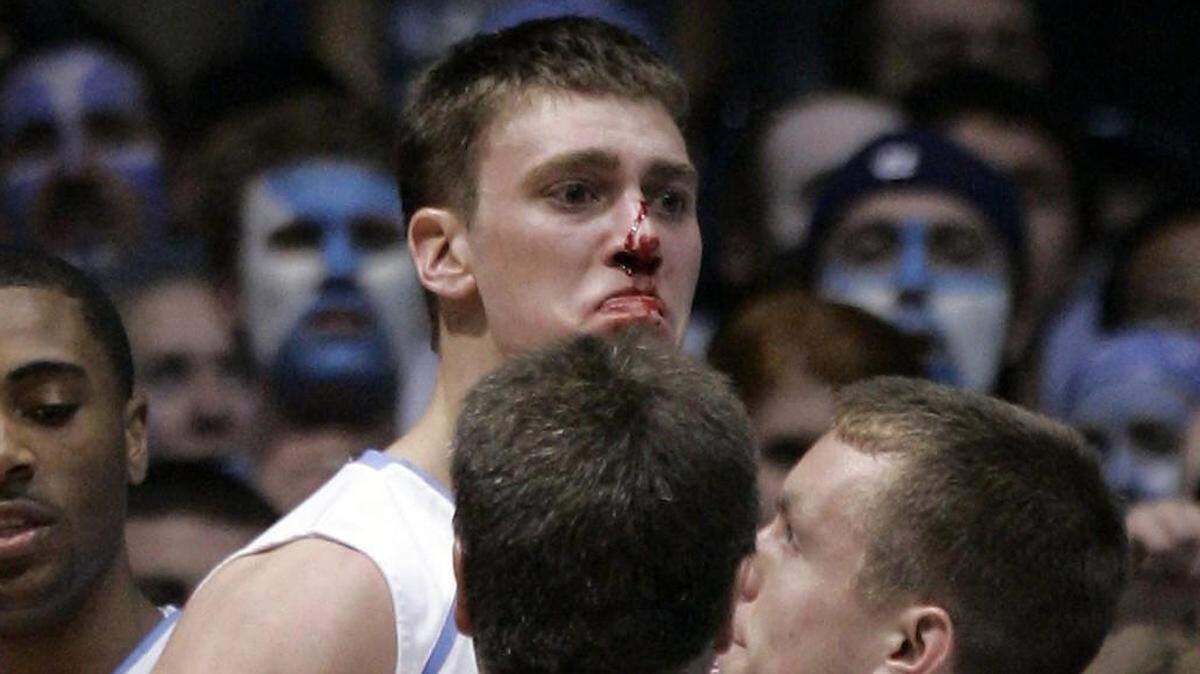 UNC’s Tyler Hansbrough, bloodied after a flagrant foul by Duke’s Gerald Henderson (not pictured), is held back by teammates after the second-half play at the Smith Center on Sunday, March 4, 2007.