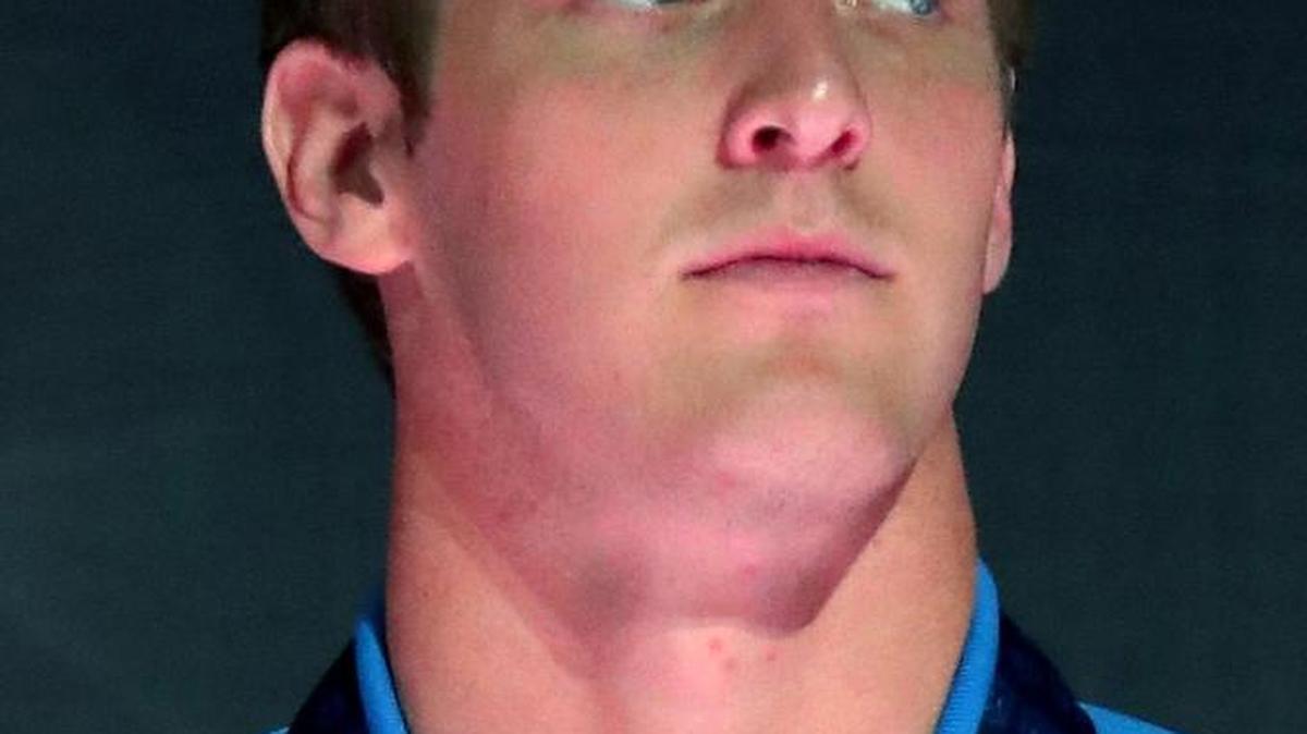 Jimmy Feigen